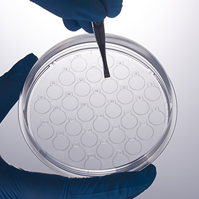 CellSLIP?細(xì)胞爬片培養(yǎng)皿,共聚焦培養(yǎng),細(xì)胞爬片