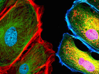 無自發(fā)熒光，成像效果佳，可用于熒光顯微實(shí)驗(yàn)、激光共聚焦顯微實(shí)驗(yàn)、熒光原位雜交（FISH）和相差顯微實(shí)驗(yàn)等